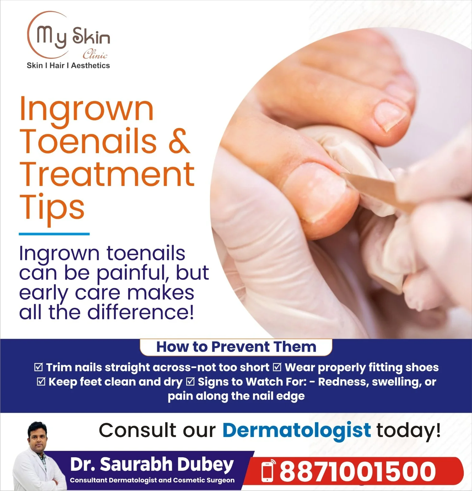 Ingrown Toenail Treatment in Indore
